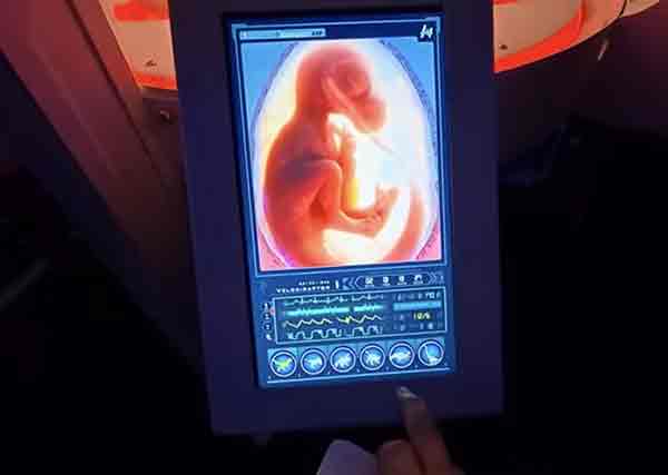 Image #2 from Suchart Y.